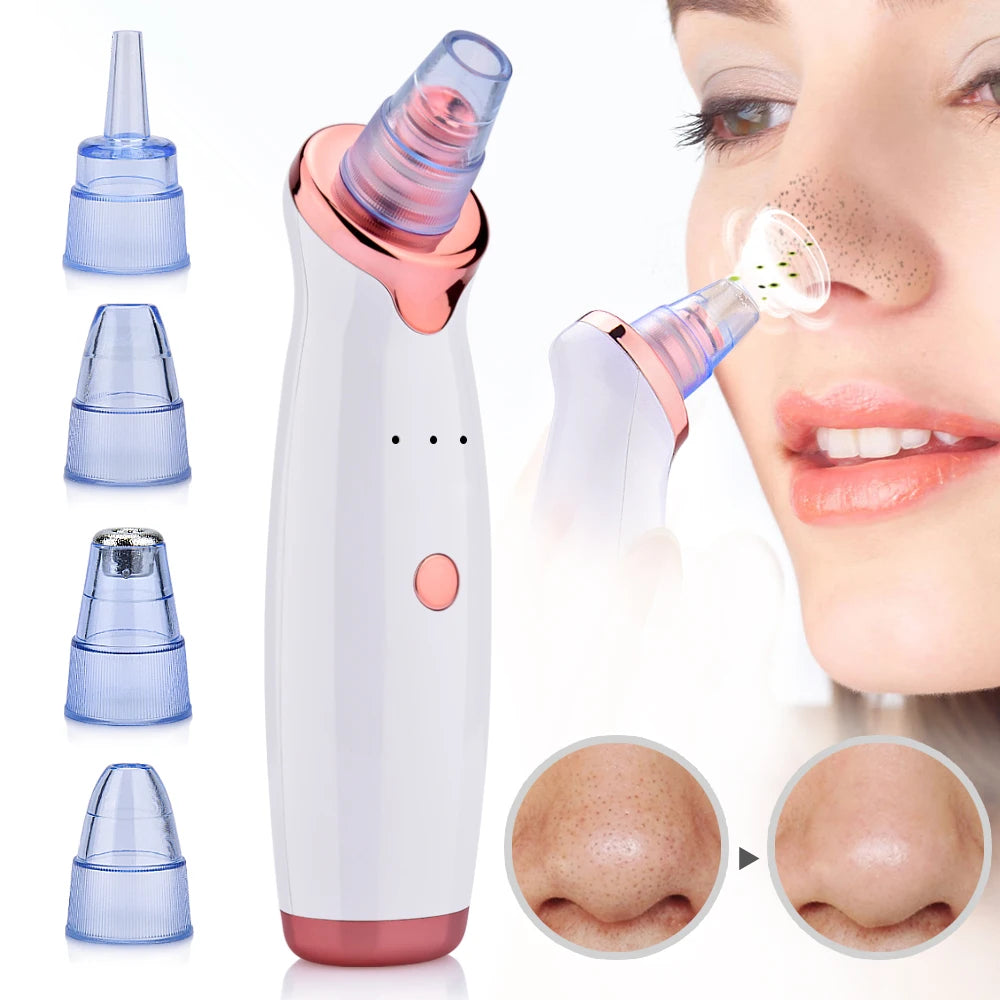 Advanced Blackhead Remover Vacuum and Facial Sprayer