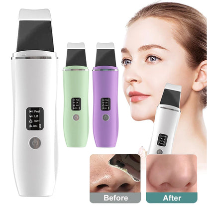 Ultrasonic Skin Scrubber Blackhead Remover Tool